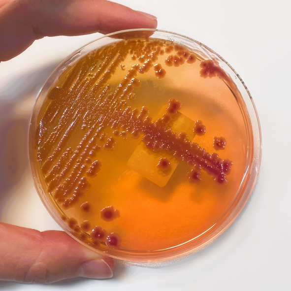 E. Coli risk
