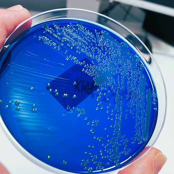 New Fungal Infection Discovered In China Poses Threat To Humans