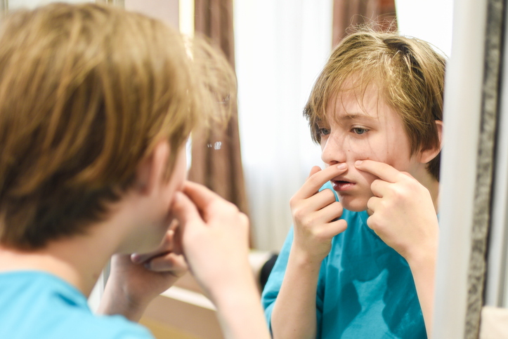 Gen Z thinks zits are in now