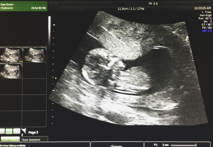 Activist judge in Georgia decides to have an opinion on abortion