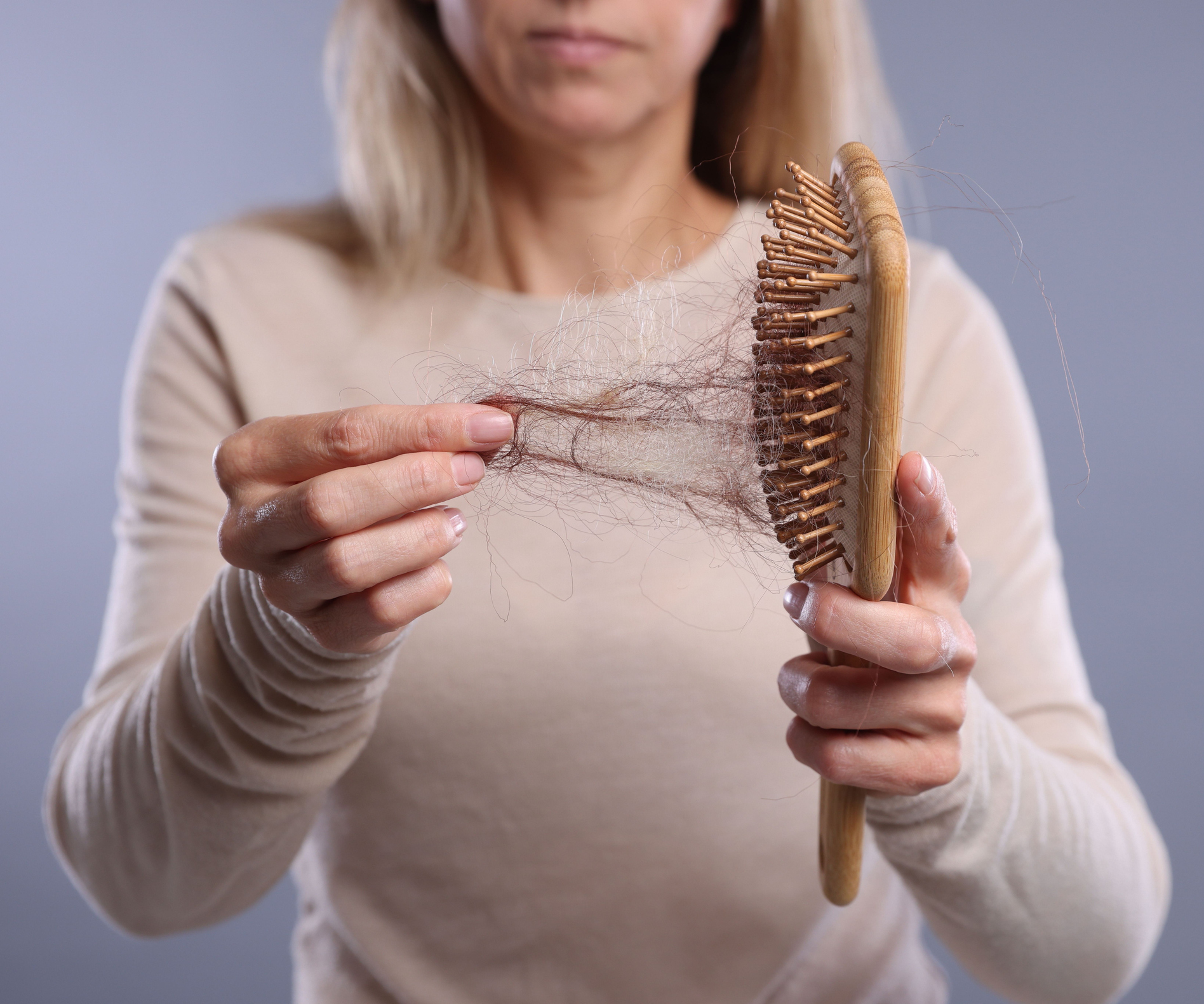 Alopecia problem. Woman taking her lost hair from brush on grey background, closeup