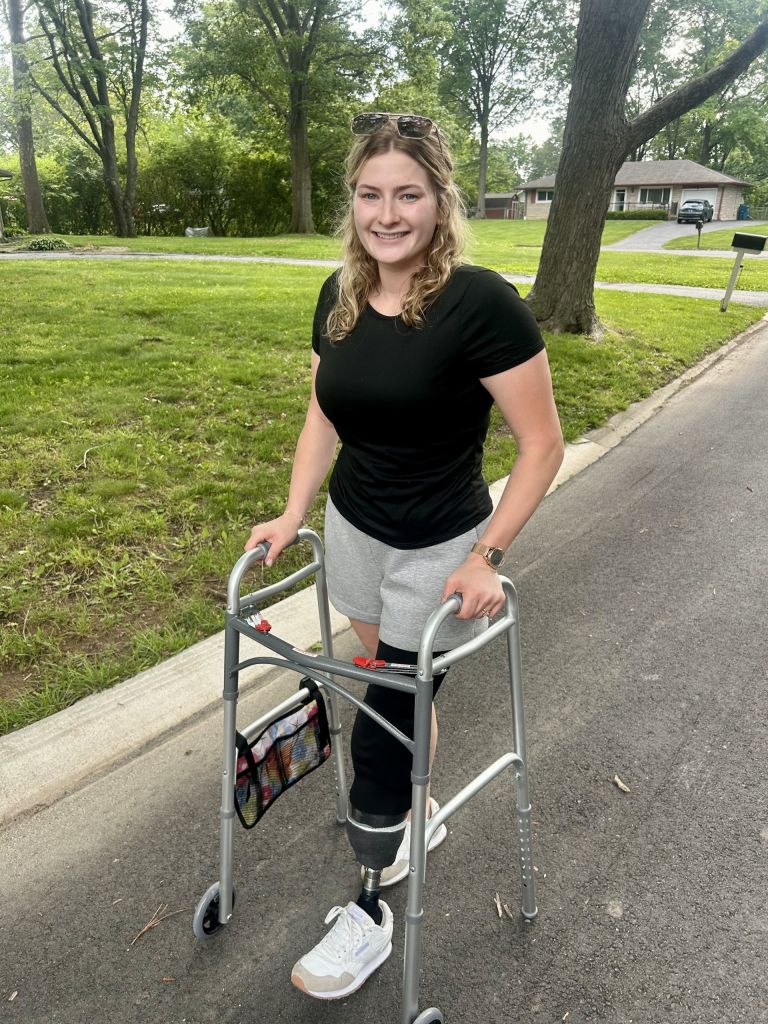 A smiling young woman with curly hair wearing a black shirt and gray shorts, using a walker and standing on a paved path in a grassy, tree-lined neighborhood.
