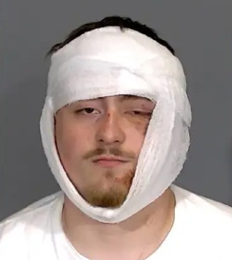 A person wearing a white bandage covering their face, with a serious expression.