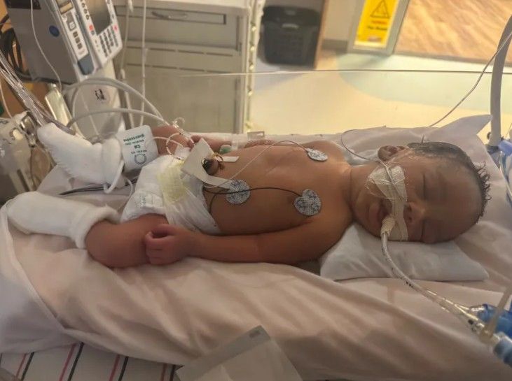 A newborn baby lying on a hospital bed, connected to medical equipment and monitors.